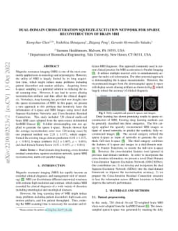 Dual-Domain Cross-Iteration Squeeze-Excitation Network for Sparse
  Reconstruction of Brain MRI