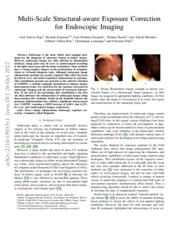 Multi-Scale Structural-aware Exposure Correction for Endoscopic Imaging