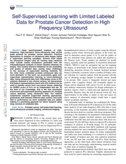 Self-Supervised Learning with Limited Labeled Data for Prostate Cancer
  Detection in High Frequency Ultrasound