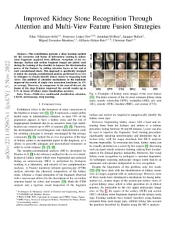 Improved Kidney Stone Recognition Through Attention and Multi-View
  Feature Fusion Strategies