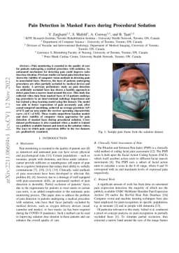 Pain Detection in Masked Faces during Procedural Sedation