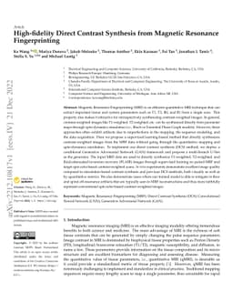 High-fidelity Direct Contrast Synthesis from Magnetic Resonance
  Fingerprinting