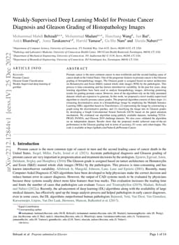 Weakly-Supervised Deep Learning Model for Prostate Cancer Diagnosis and
  Gleason Grading of Histopathology Images