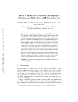 Holistic Multi-Slice Framework for Dynamic Simultaneous Multi-Slice MRI
  Reconstruction