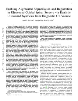 Enabling Augmented Segmentation and Registration in Ultrasound-Guided
  Spinal Surgery via Realistic Ultrasound Synthesis from Diagnostic CT Volume