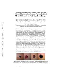Diffusion-based Data Augmentation for Skin Disease Classification:
  Impact Across Original Medical Datasets to Fully Synthetic Images