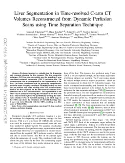 Liver Segmentation in Time-resolved C-arm CT Volumes Reconstructed from
  Dynamic Perfusion Scans using Time Separation Technique