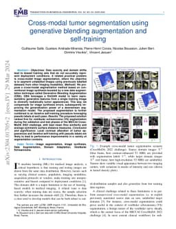 Cross-modal tumor segmentation using generative blending augmentation
  and self training