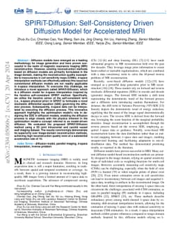 SPIRiT-Diffusion: Self-Consistency Driven Diffusion Model for
  Accelerated MRI