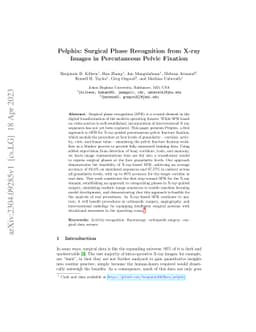Pelphix: Surgical Phase Recognition from X-ray Images in Percutaneous
  Pelvic Fixation