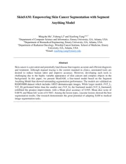 SkinSAM: Empowering Skin Cancer Segmentation with Segment Anything Model