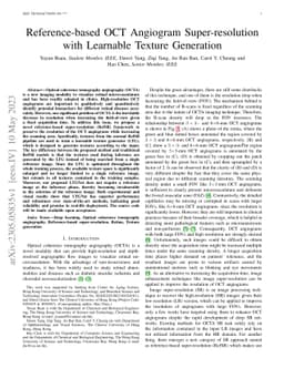 Reference-based OCT Angiogram Super-resolution with Learnable Texture
  Generation