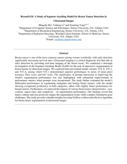 BreastSAM: A Study of Segment Anything Model for Breast Tumor Detection
  in Ultrasound Images