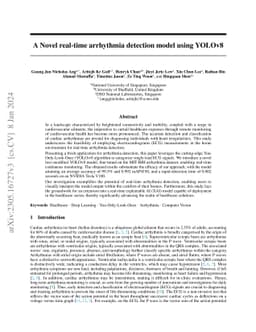 A Novel real-time arrhythmia detection model using YOLOv8