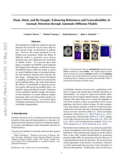 Mask, Stitch, and Re-Sample: Enhancing Robustness and Generalizability
  in Anomaly Detection through Automatic Diffusion Models