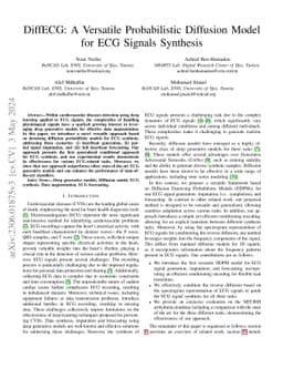 DiffECG: A Versatile Probabilistic Diffusion Model for ECG Signals
  Synthesis