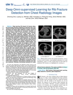 Deep Omni-supervised Learning for Rib Fracture Detection from Chest
  Radiology Images