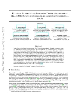 Faithful Synthesis of Low-dose Contrast-enhanced Brain MRI Scans using
  Noise-preserving Conditional GANs