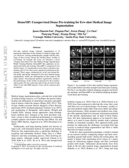 DenseMP: Unsupervised Dense Pre-training for Few-shot Medical Image
  Segmentation