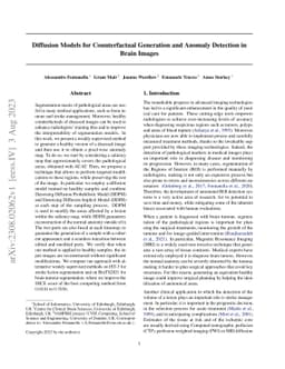 Diffusion Models for Counterfactual Generation and Anomaly Detection in
  Brain Images