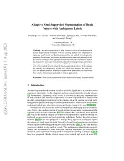 Adaptive Semi-Supervised Segmentation of Brain Vessels with Ambiguous
  Labels