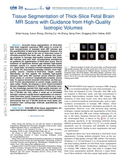 Tissue Segmentation of Thick-Slice Fetal Brain MR Scans with Guidance
  from High-Quality Isotropic Volumes