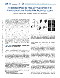 Federated Pseudo Modality Generation for Incomplete Multi-Modal MRI
  Reconstruction