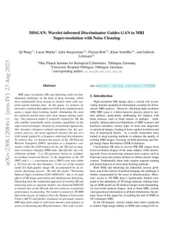 DISGAN: Wavelet-informed Discriminator Guides GAN to MRI
  Super-resolution with Noise Cleaning