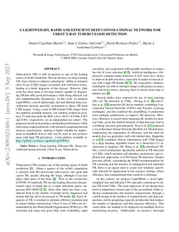 A Lightweight, Rapid and Efficient Deep Convolutional Network for Chest
  X-Ray Tuberculosis Detection
