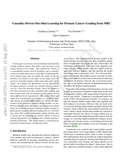 Causality-Driven One-Shot Learning for Prostate Cancer Grading from MRI