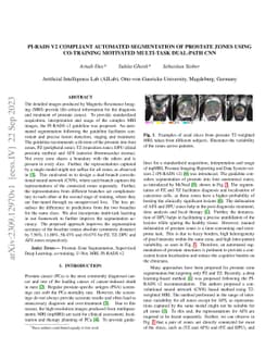PI-RADS v2 Compliant Automated Segmentation of Prostate Zones Using
  co-training Motivated Multi-task Dual-Path CNN