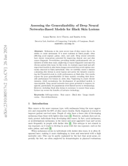 Assessing the Generalizability of Deep Neural Networks-Based Models for
  Black Skin Lesions