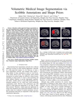 Volumetric Medical Image Segmentation via Scribble Annotations and Shape
  Priors