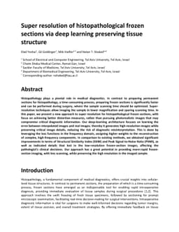 Super resolution of histopathological frozen sections via deep learning
  preserving tissue structure