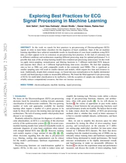 Exploring Best Practices for ECG Signal Processing in Machine Learning