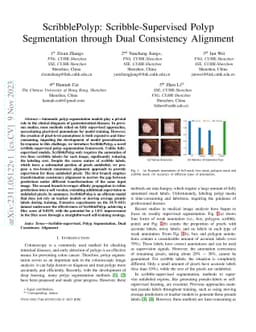 ScribblePolyp: Scribble-Supervised Polyp Segmentation through Dual
  Consistency Alignment