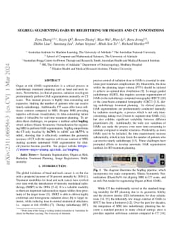 SegReg: Segmenting OARs by Registering MR Images and CT Annotations