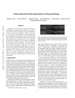 Motion Informed Needle Segmentation in Ultrasound Images
