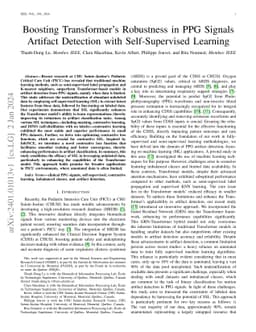 Boosting Transformer's Robustness and Efficacy in PPG Signal Artifact
  Detection with Self-Supervised Learning