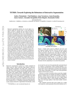 TETRIS: Towards Exploring the Robustness of Interactive Segmentation