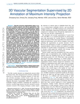 3D Vascular Segmentation Supervised by 2D Annotation of Maximum
  Intensity Projection