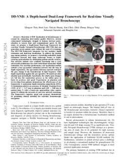 DD-VNB: A Depth-based Dual-Loop Framework for Real-time Visually
  Navigated Bronchoscopy