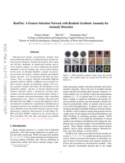 RealNet: A Feature Selection Network with Realistic Synthetic Anomaly
  for Anomaly Detection