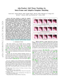 Ada-Tracker: Soft Tissue Tracking via Inter-Frame and Adaptive-Template
  Matching