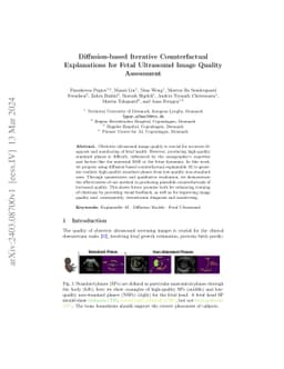 Diffusion-based Iterative Counterfactual Explanations for Fetal
  Ultrasound Image Quality Assessment