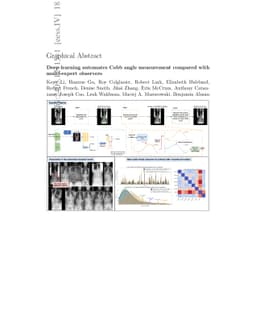 Deep learning automates Cobb angle measurement compared with
  multi-expert observers