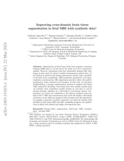 Improving cross-domain brain tissue segmentation in fetal MRI with
  synthetic data