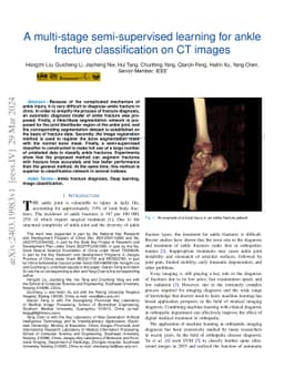 A multi-stage semi-supervised learning for ankle fracture classification
  on CT images