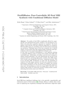 FetalDiffusion: Pose-Controllable 3D Fetal MRI Synthesis with
  Conditional Diffusion Model
