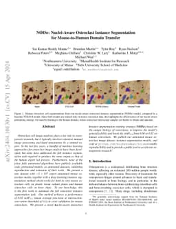 NOISe: Nuclei-Aware Osteoclast Instance Segmentation for Mouse-to-Human
  Domain Transfer